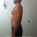 After-Passive-Extension-Treatment