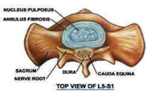 nucleus-degenerative-vancouver